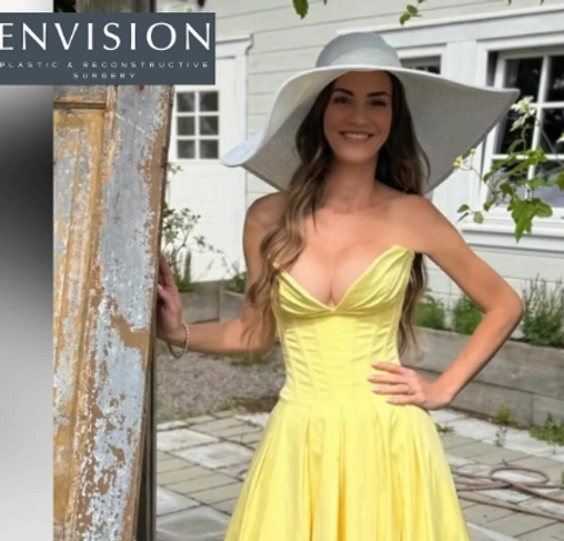 Breast Cancer Reconstruction — clinical photograph 4 from Envision Plastic Surgery