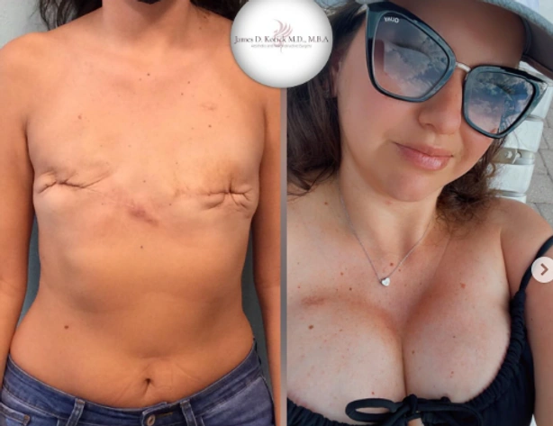 Microsurgical reconstruction — clinical photograph 1 from Envision Plastic Surgery