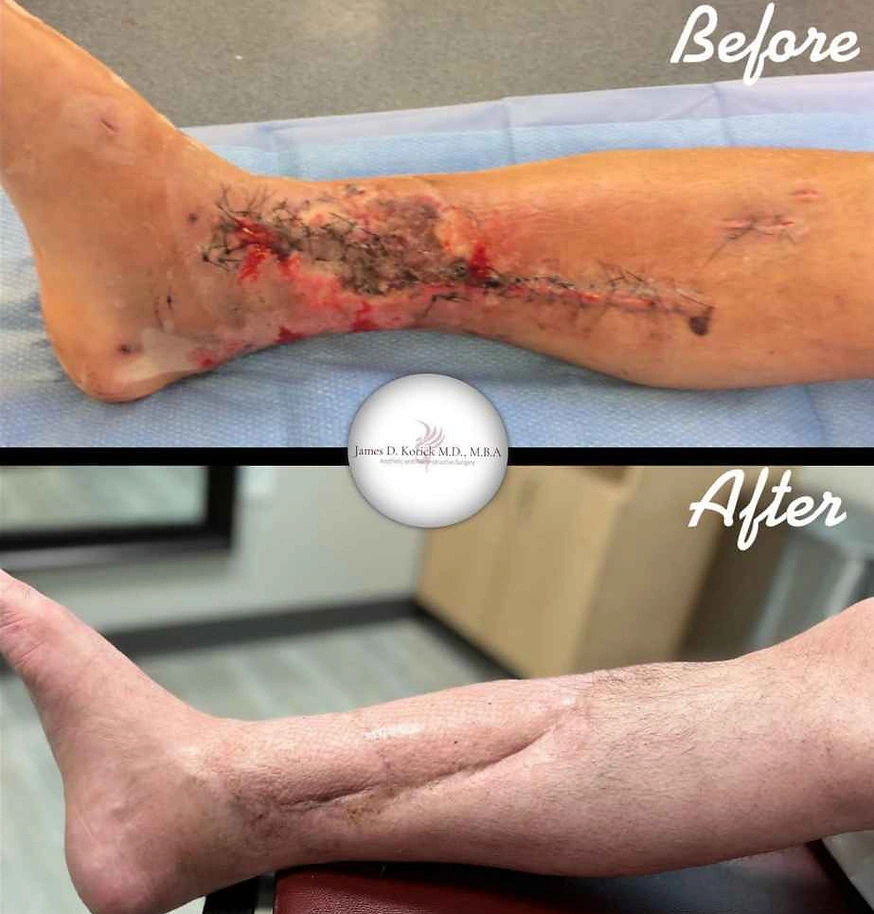 Microsurgical reconstruction — clinical photograph 6 from Envision Plastic Surgery